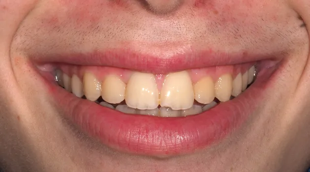 dientes1